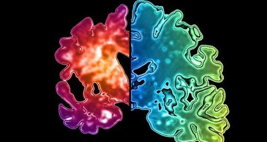 alzheimer-insandan-insana-bulasabilir-mi-ameliyat-kan-nakli-ve-dis-tedavisi8230-26852 Alzheimer insandan insana bulaşabilir mi? Ameliyat, kan nakli ve diş tedavisi…