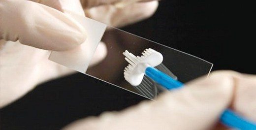 bobrek-kanseri-icin-kullanilan-ilac-rahim-agzi-kanserinde-omru-uzatiyor-71685 Böbrek kanseri için kullanılan ilaç rahim ağzı kanserinde ömrü uzatıyor