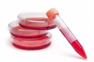 hepatit-b8217de-tedavi-uyumu-ve-devamliligi-98779 Hepatit B’de tedavi uyumu ve devamlılığı