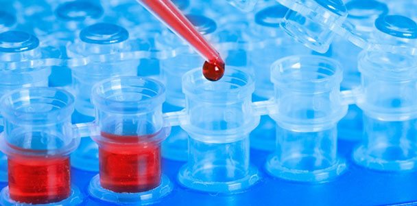 kan-testlerini-unutun-hastaliklari-nefesle-teshis-eden-elektronik-burun-geliyor-66282 Kan testlerini unutun, hastalıkları nefesle teşhis eden elektronik burun geliyor!