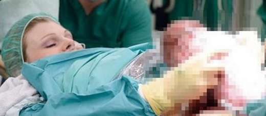 prof-dr-demir-onlem-alinmazsa-sezaryen-orani-808217e-cikacak-20836 Prof. Dr. Demir: Önlem alınmazsa sezaryen oranı %80’e çıkacak