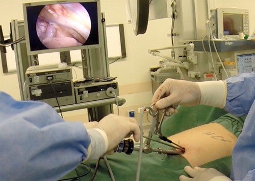 robotik-cerrahi-urolojide-hangi-hastaliklarin-tedavisinde-kullaniliyor-24560 Robotik cerrahi ürolojide hangi hastalıkların tedavisinde kullanılıyor?