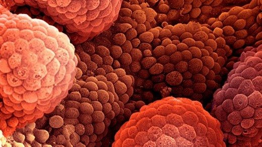 yeni-nesil-ilaclar-prostat-kanseri-tedavisinde-yasam-suresini-uzatiyor-65875 Yeni nesil ilaçlar, Prostat kanseri tedavisinde yaşam süresini uzatıyor